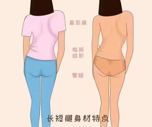 详细阅读:胯是哪个部位(胯是哪个部位?) 胯是哪个部位(胯是哪个部位?)